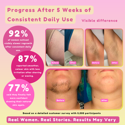 Cyperus Rotundas Hair-Removal Oil 60ml / 2 fl oz